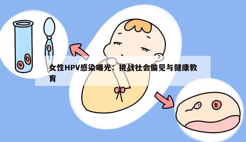 女性HPV感染曝光：挑战社会偏见与健康教育