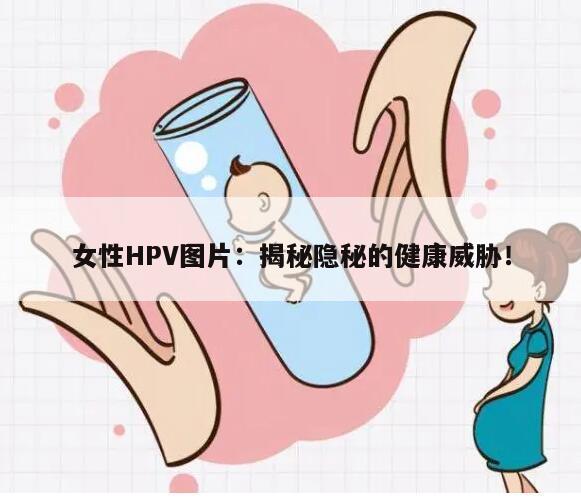 女性HPV图片：揭秘隐秘的健康威胁！