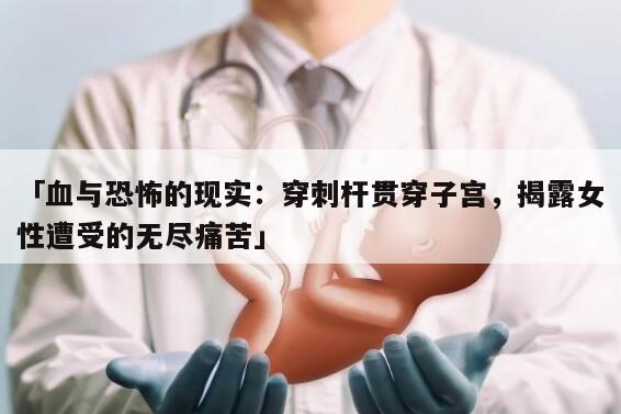 「血与恐怖的现实：穿刺杆贯穿子宫，揭露女性遭受的无尽痛苦」