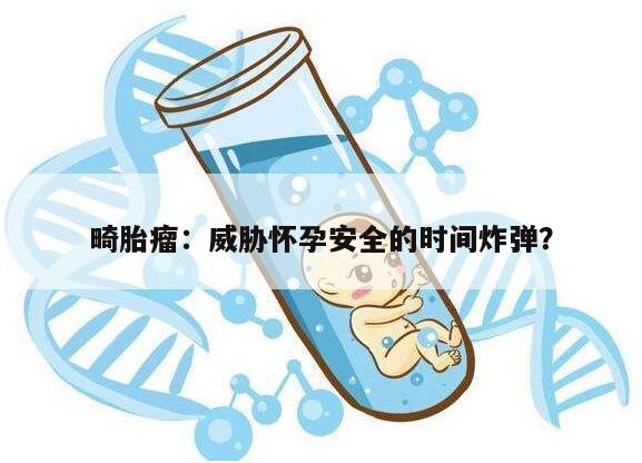 畸胎瘤：威胁怀孕安全的时间炸弹？