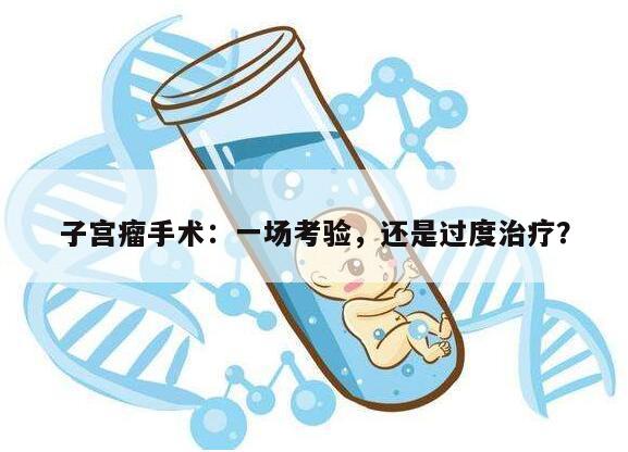 子宫瘤手术：一场考验，还是过度治疗？