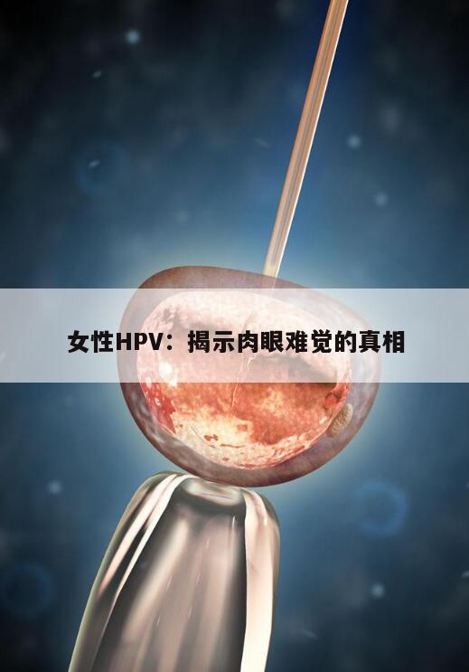 女性HPV：揭示肉眼难觉的真相