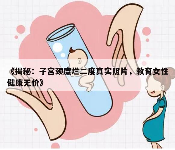 《揭秘：子宫颈糜烂二度真实照片，教育女性健康无价》