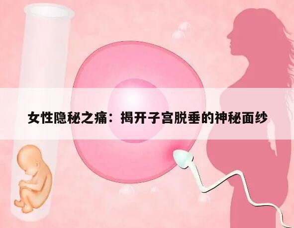 女性隐秘之痛：揭开子宫脱垂的神秘面纱